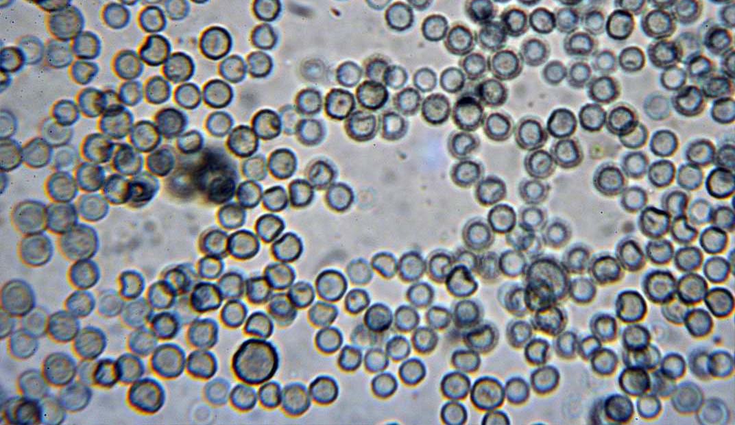 Mold Spores Under Microscope